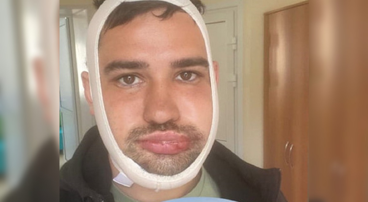 Захар Саленко получил травмы после драки в клубе: требуется специальное питание